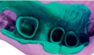 Durosil s