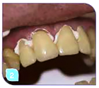      ProviTemp