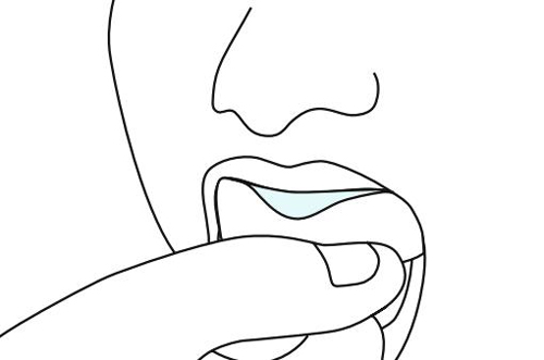 - Speedex light body,  