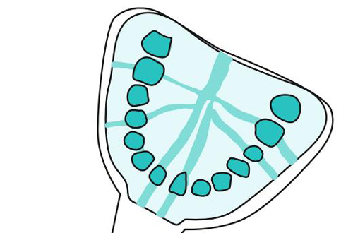 - Speedex light body,  