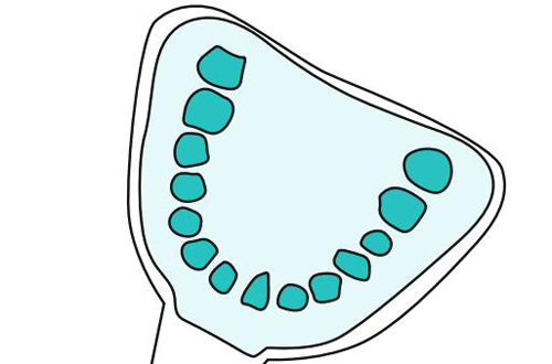 - Speedex light body,  