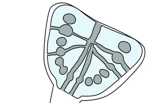 - Speedex light body,  