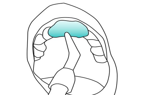 - Speedex light body,  