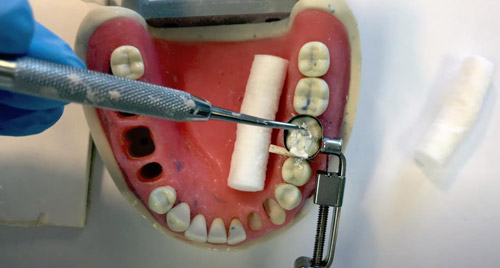   IRM Dentsply