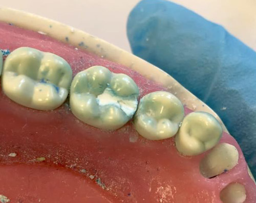   IRM Dentsply