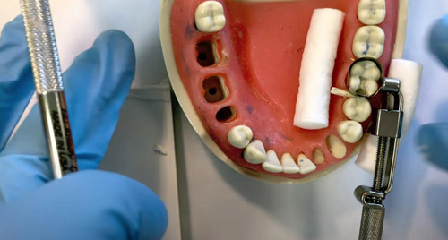   IRM Dentsply