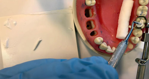   IRM Dentsply