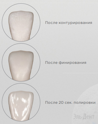 NEO SPECTRA    DENTSPLY SIRONA