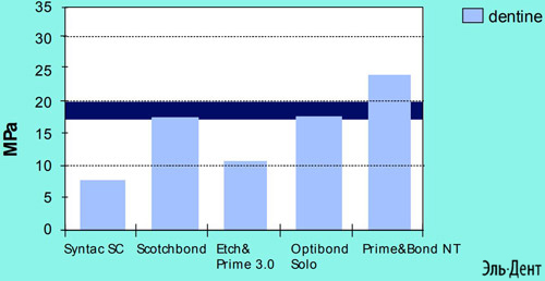    PRIME BOND NT DENTSPLY