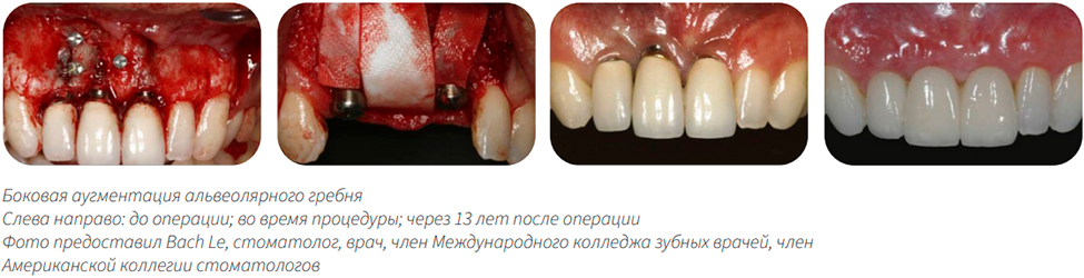 OSSIX Plus  