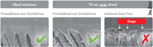   PRIME BOND one ETCH RINSE