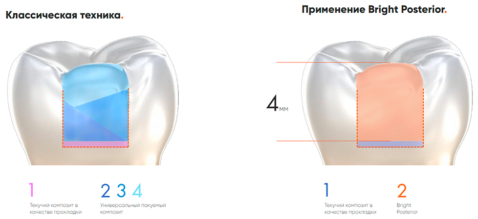  Bright Posterior