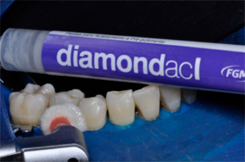   FGM Diamond ACI & ACII