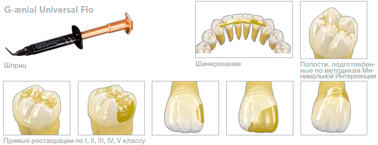   G-aenial Universal FLO