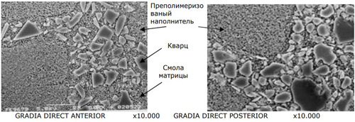   Gradia Direct - 