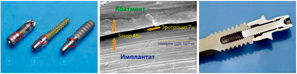 GapSeal