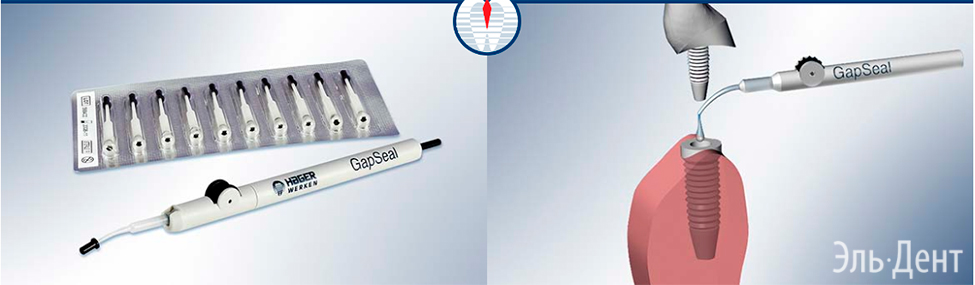 GapSeal-  