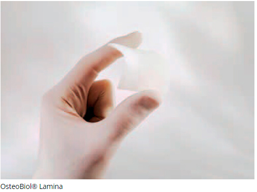   Osteobiol Soft Cortical Lamina
