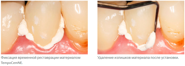      TempoCemNE