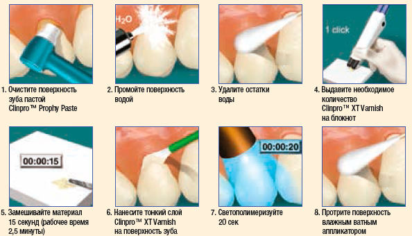 Clinpro XT Varnish &ndash; �������� �������� ����������������� �������