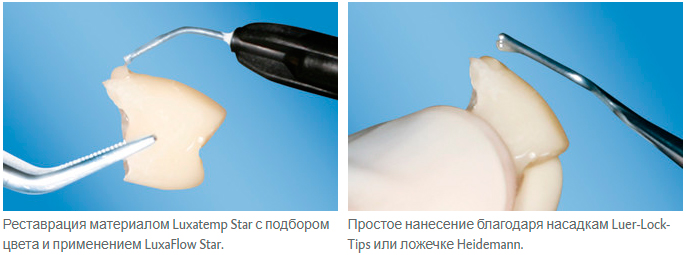    Luxa Flow Star