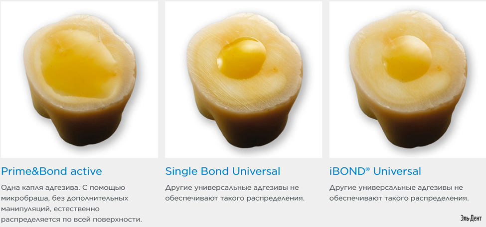  Prime Bond Universal