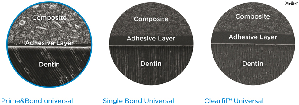  Prime Bond Universal