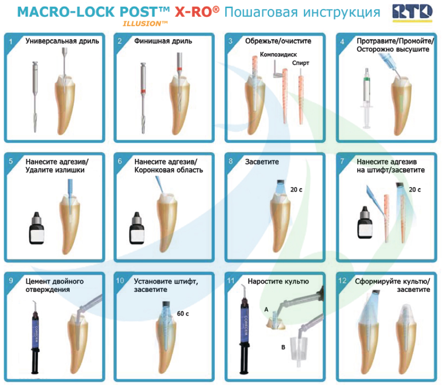   RTD Macro-Lock Post illusion X-RO