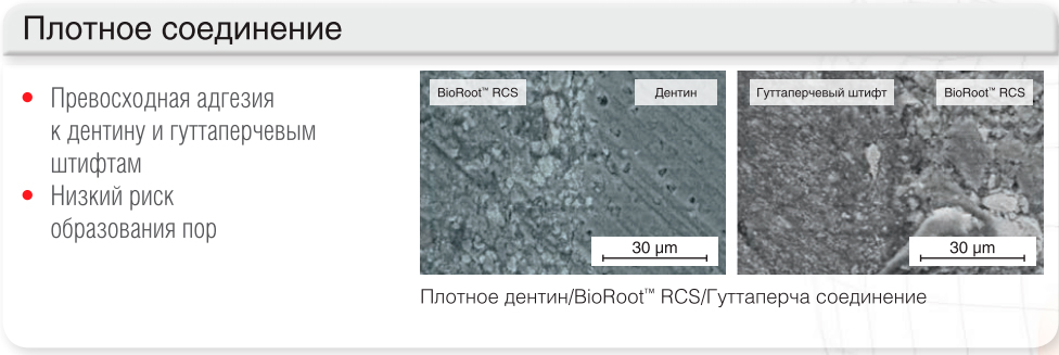 bioroot rcs