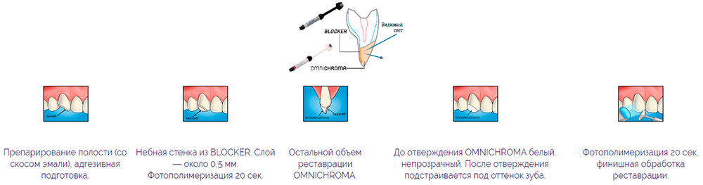 Omnichroma blocker