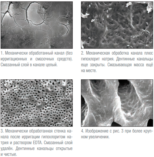     EDTA 18% Soluttion 30  UL162, Ultradent