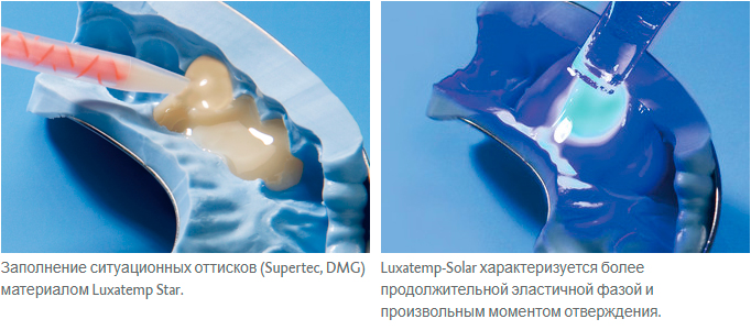 LUXATEMP AUTOMIX PLUS
