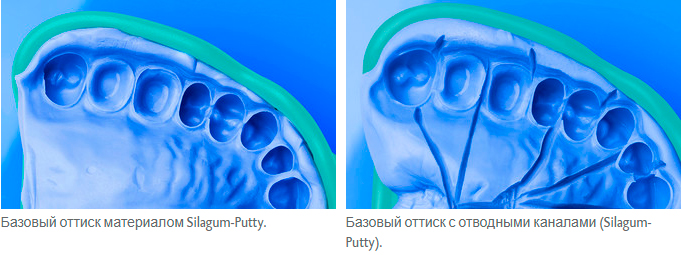    SILAGUM Putty Standart