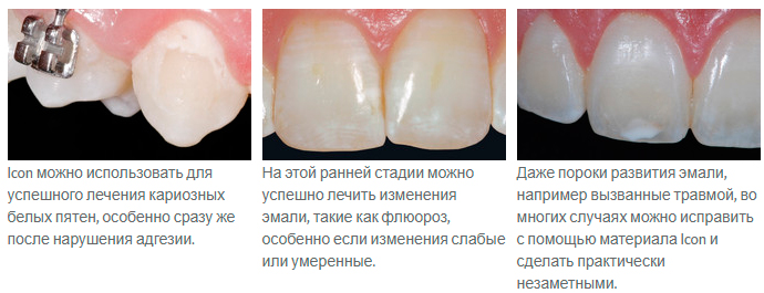 Icon –      