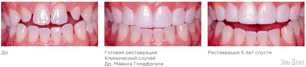   Spectrum TPH 3